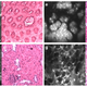 Ilustración para el artículo titulado Este pequeño microscopio puede detectar el cáncer directamente en la consulta del médico